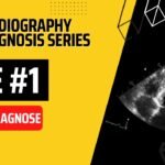 Echocardiography Case 1: Understanding a Complex Heart Condition