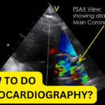 How To Do Echo – Mastering Echocardiography with Real-Life Cases