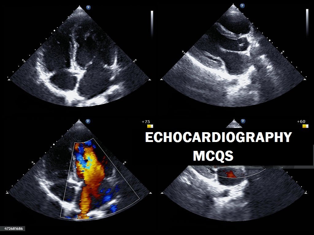 Echocardiography MCQs