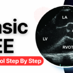 How to do Transesophageal Echocardiography (TEE) – Basic Echo Views